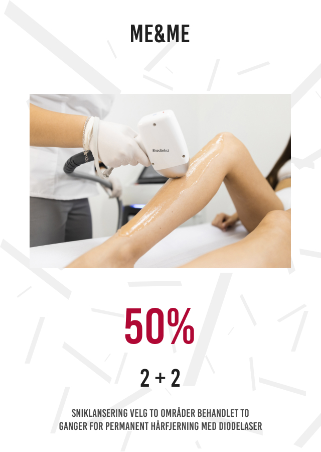 50% 2+2 sniklansering permanent hårfjerning